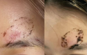 王礼君荣获拾遗传承“王氏传统膏药制作技艺非物质文化遗产传承人”称号